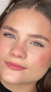 Modelowanie ust kwasem hialuronowym #ustaswinoujscie #kwashialuronowyswinoujscie #kosmetologswinoujscie #filler #lipsfiller #medycynaestetyczna #medycynaestetycznaswinoujscie