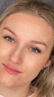 Modelowanie ust kwasem hialuronowym #kwashialuronowy #wypelnianieust #powiekszanieust #modelowanieust #estetykamedyczna #medycynaestetyczna #zabiegestetyczny #pieknousta #naturalneusta #usta #swinoujscieuroda #ahlbeck #heringsdorf #berlin #hamburg #medycynaestetycznaswinoujscie