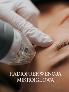 Radiofrekwencja mikroigłowa to technologia łącząca mikronakłucia z energią fal radiowych, używana w celu odmłodzenia i regeneracji skóry. Urządzenie wprowadza mikroigły na regulowaną głębokość, emitując fale radiowe, co stymuluje produkcję kolagenu. Jak działa
* Podczas zabiegu bardzo cienkie igły są wprowadzane w skórę na głębokość od 0.1 do 4.0 mm.
* Igły emitują bipolarne fale radiowe, które bardzo silnie ale krótko nagrzewają tkankę wokół nich, nie przegrzewając powierzchni skóry.
* Powstałe ogniska koagulacji i przegrzania inicjują przebudowę podskórnego kolagenu.
* Wprowadzenie igieł na różne poziomy skóry daje efekt przestrzennego ujędrnienia. Korzyści
* Odmłodzenie i poprawa jędrności skóry.
* Redukcja blizn, rozstępów i niedoskonałości.
* Redukcja przebarwień (plam posłonecznych, potrądzikowych, starczych).
* Poprawa nawilżenia skóry.
* Poprawa mikrokrążenia i metabolizmu skóry.
#swinoujscieuroda #radiofrekwencjamikroigłowa #kosmetologswinoujscie #medycynaestetycznaswinoujscie #radiofrequencymicroneedling #rfmikroigłowa
